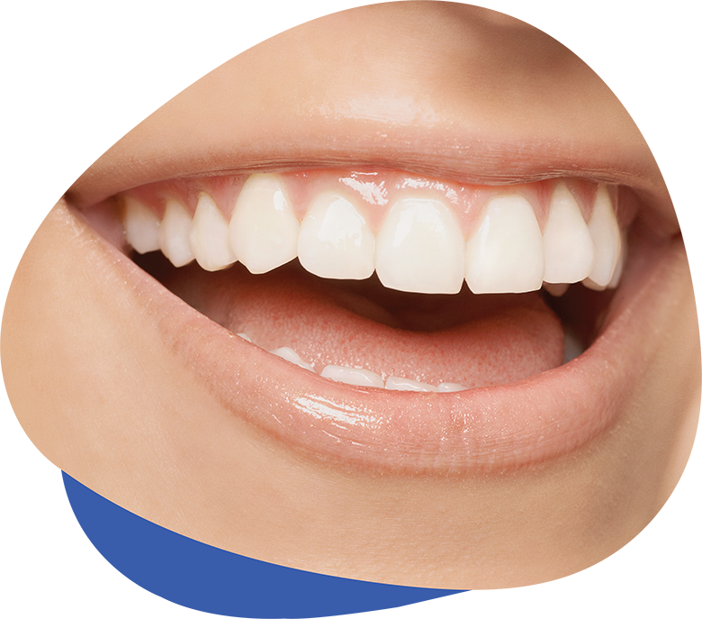 https://www.westervilledental.com/wp-content/uploads/2019/11/WDA_Periodontal_Therapy.png
