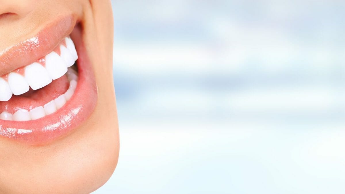 How long does teeth whitening take?