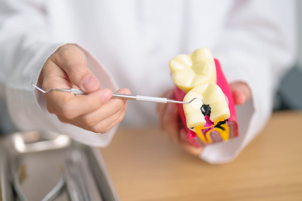 10 Causes of Tooth Decay Beyond Sugar - Westerville Dental Associates